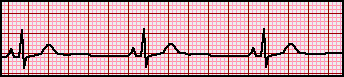 heart_rate1.png