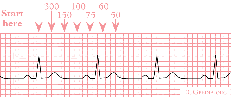 heart_rate_method.png
