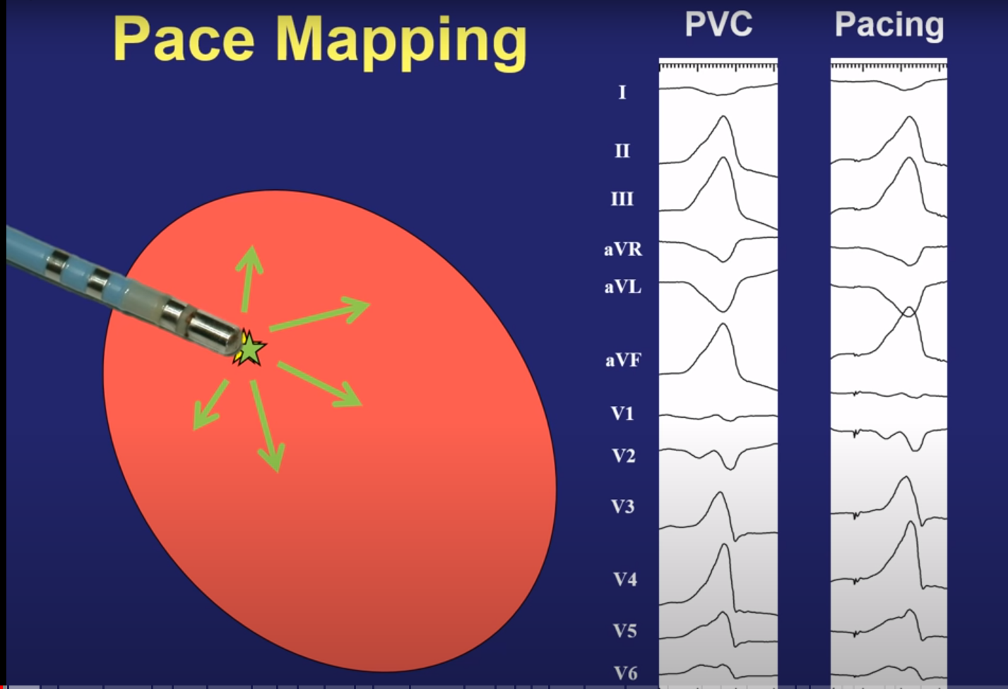 pacemap_principle.png