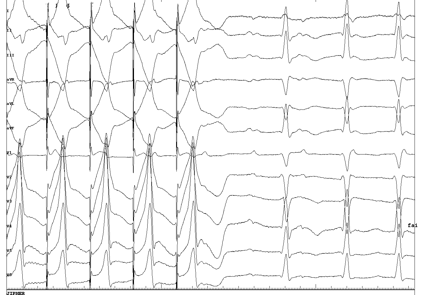 2021_jayanthi_lupv_at_p_morphology.JPG