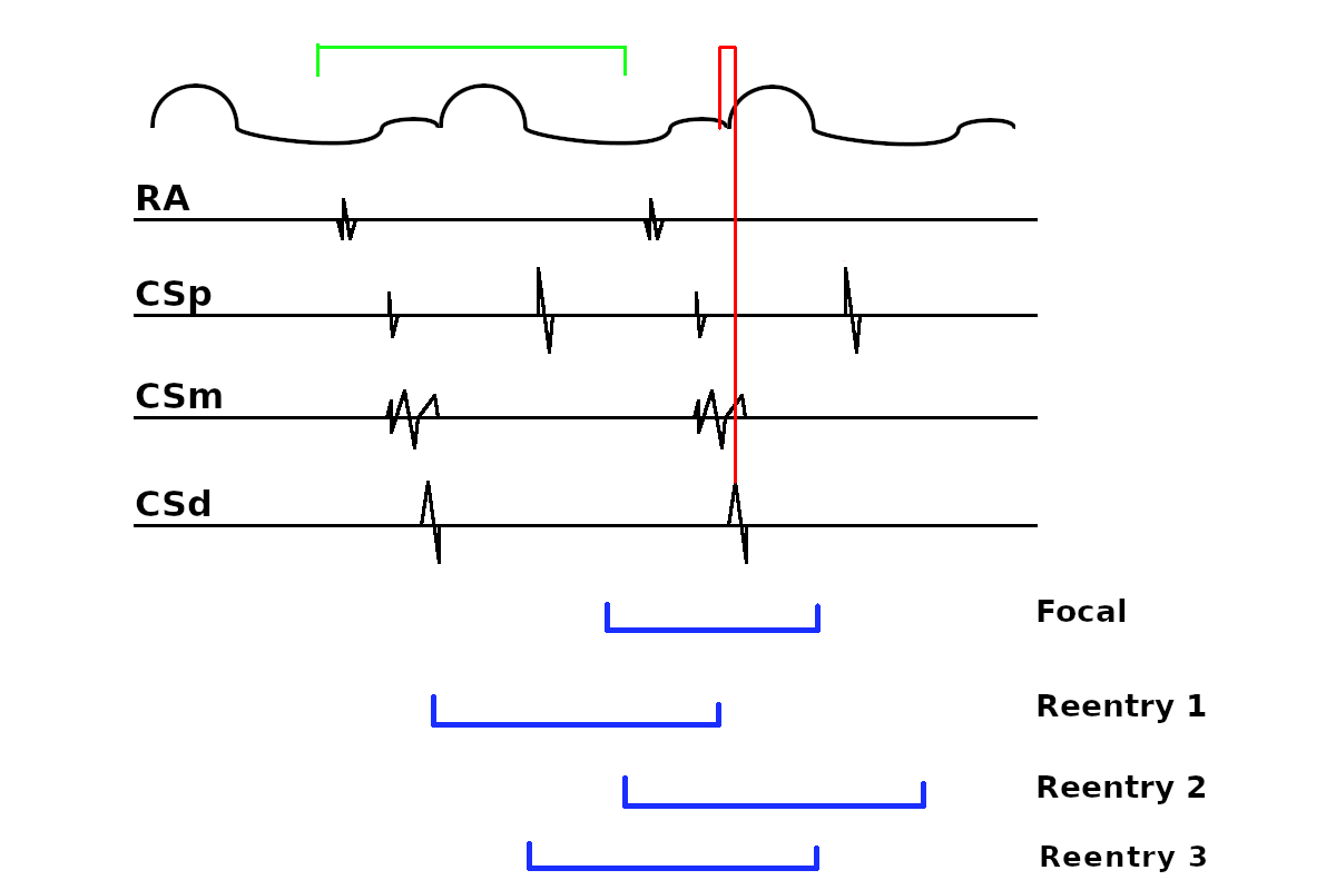 schematic_window.png