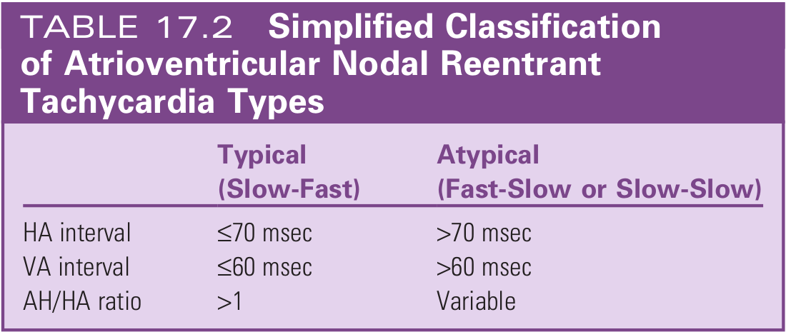 avnrt_classification.png