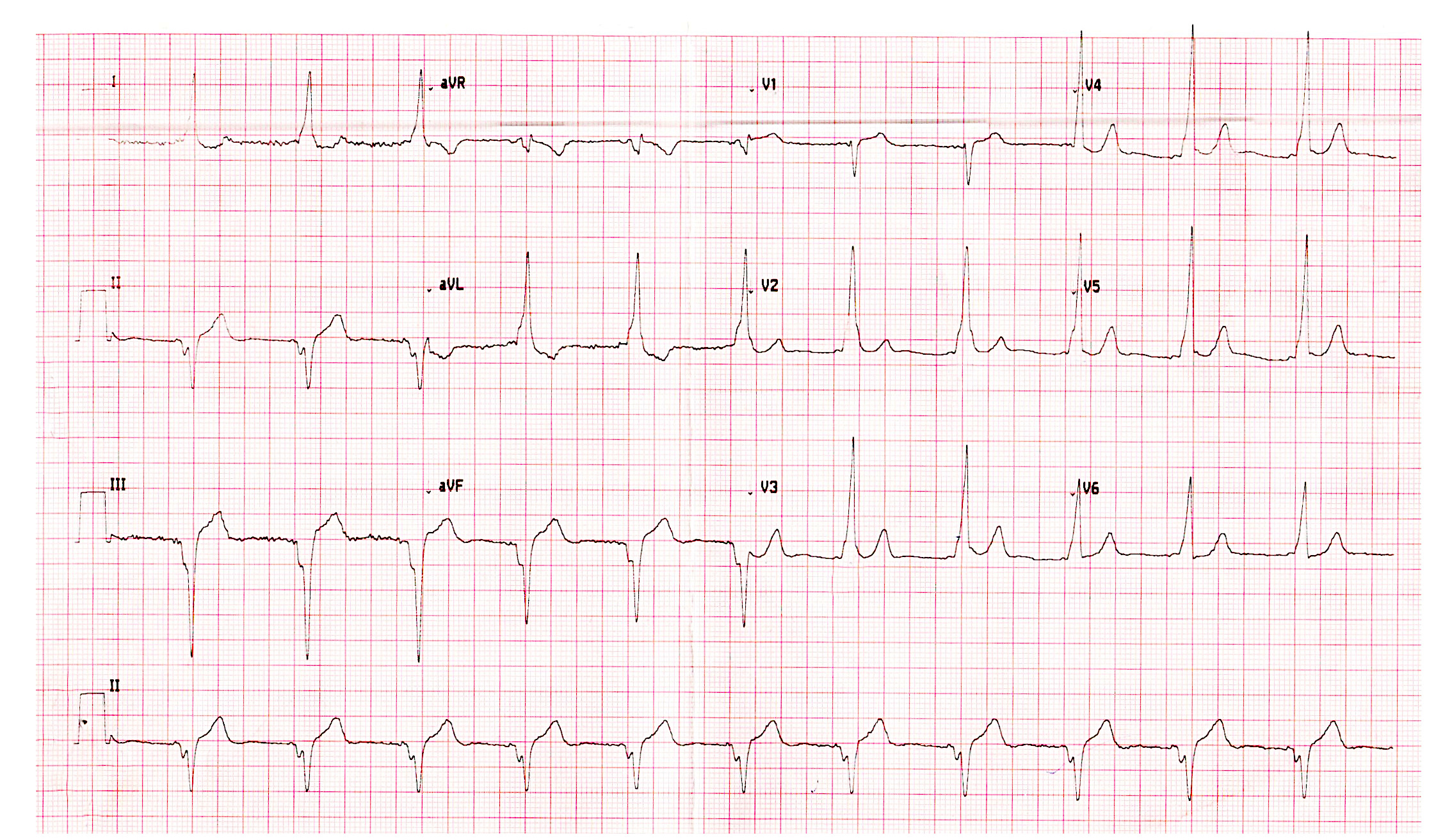 ecg.jpg