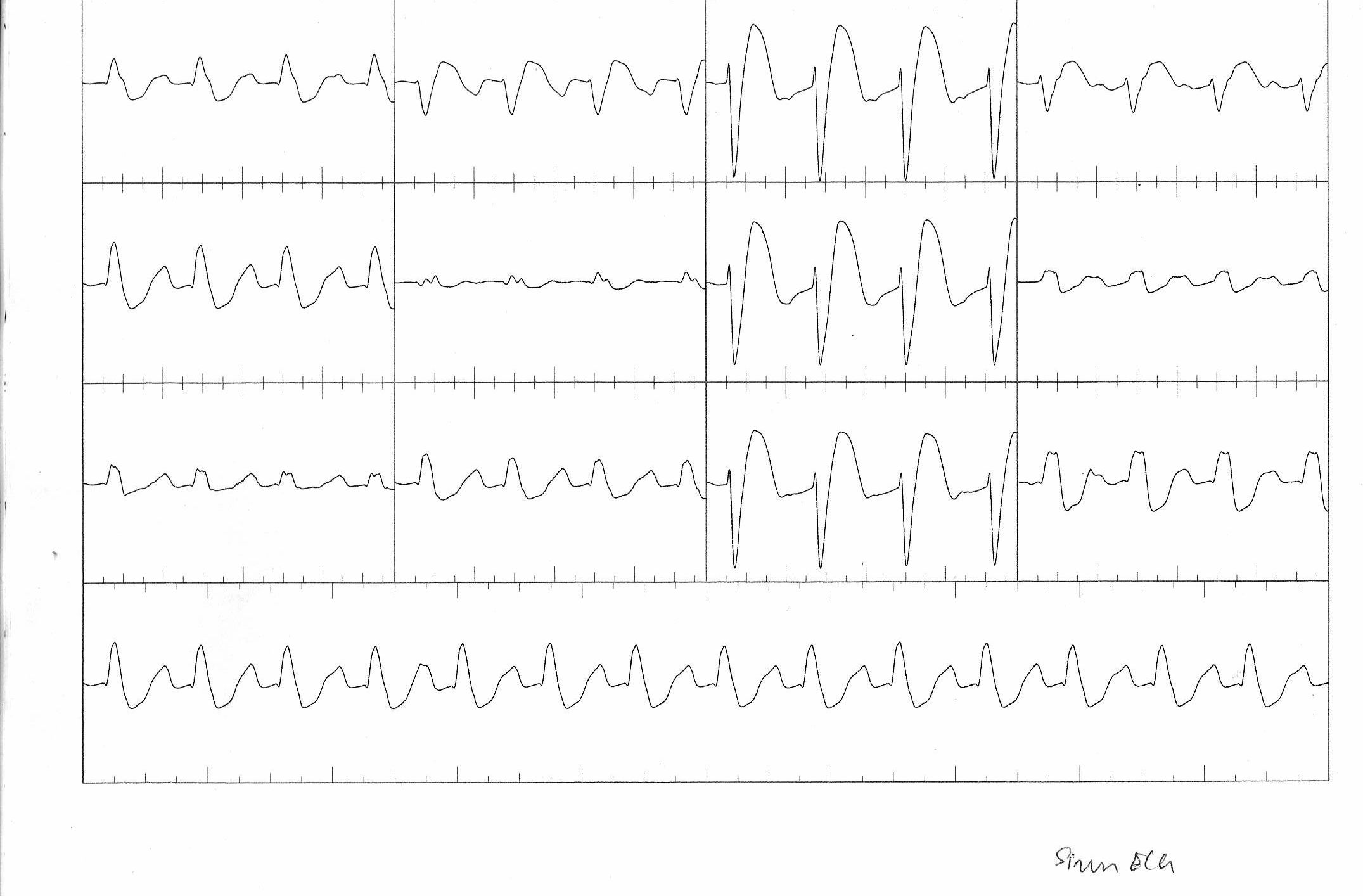 01_sinus_ecg.jpg