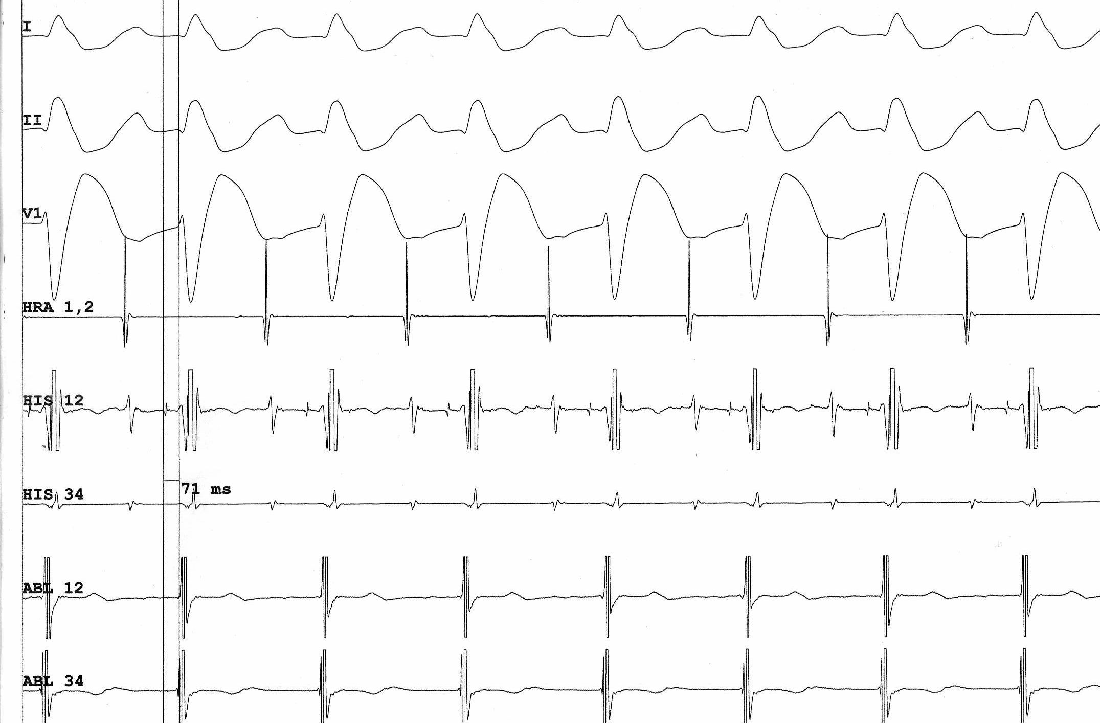 02_baseline_IC.jpg