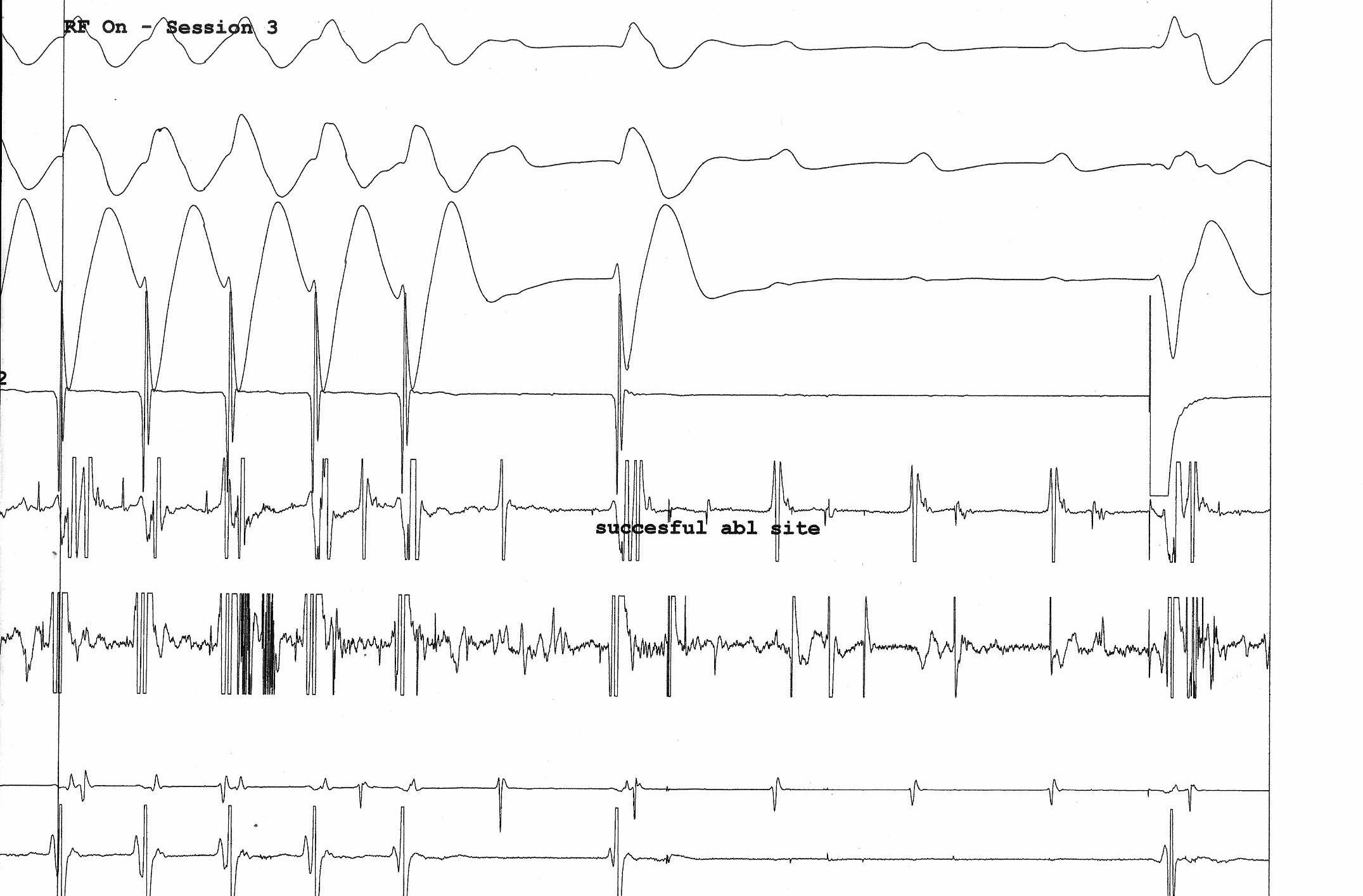 09_ablation.jpg