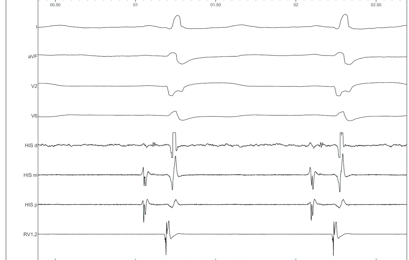 basal_IC.jpg