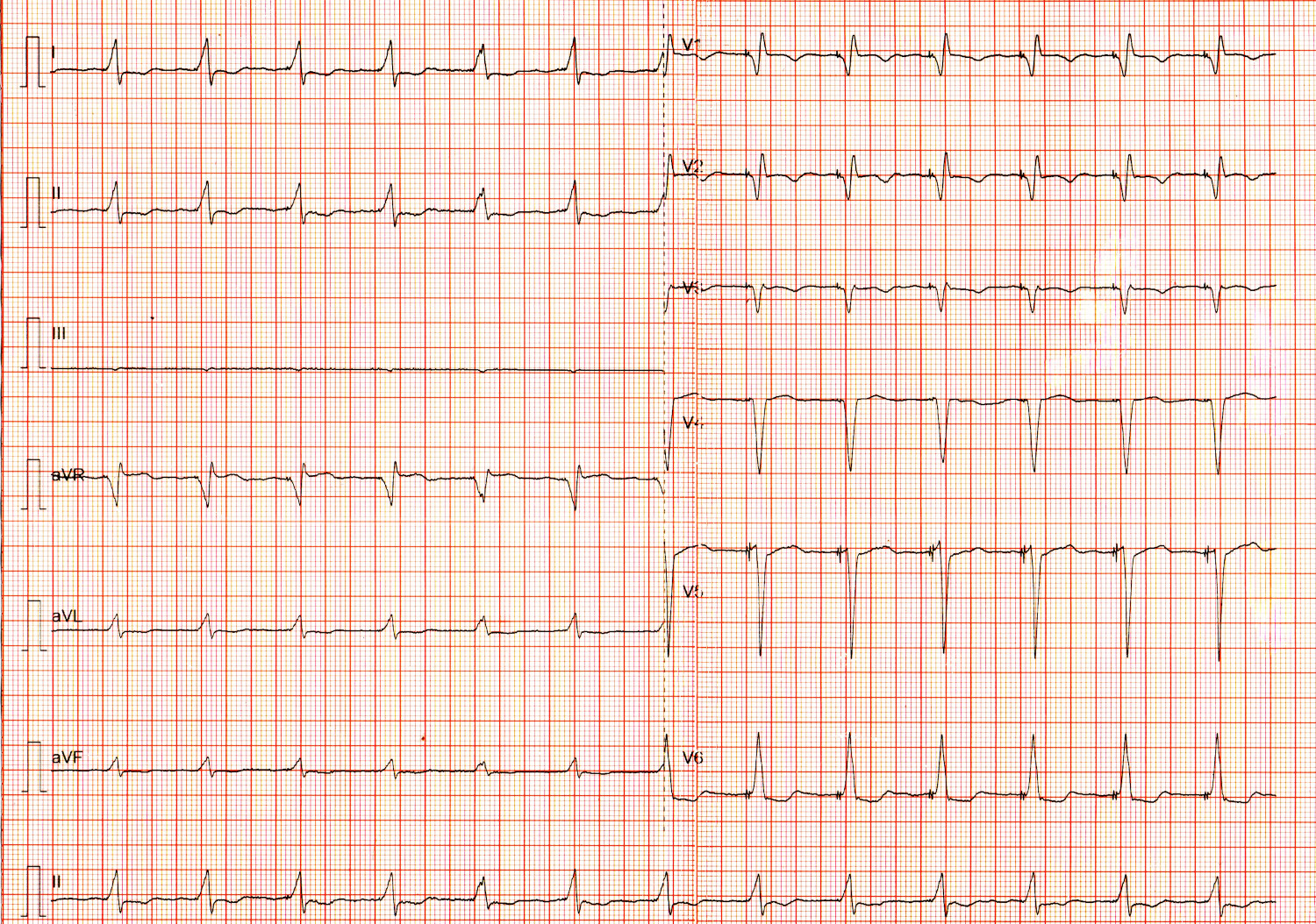 ecg_avja.jpg