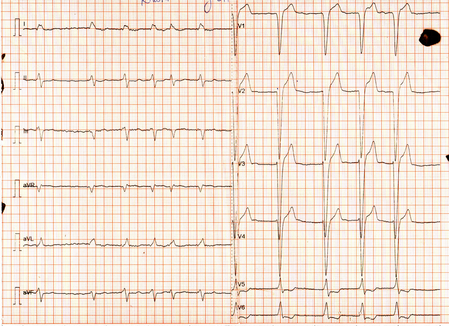 ecg_presentation.jpg