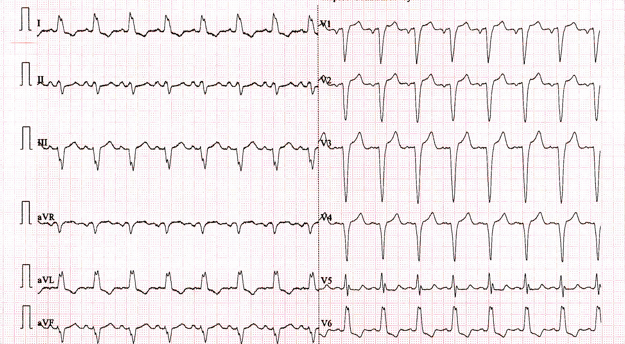 01_sinus_ecg.jpg