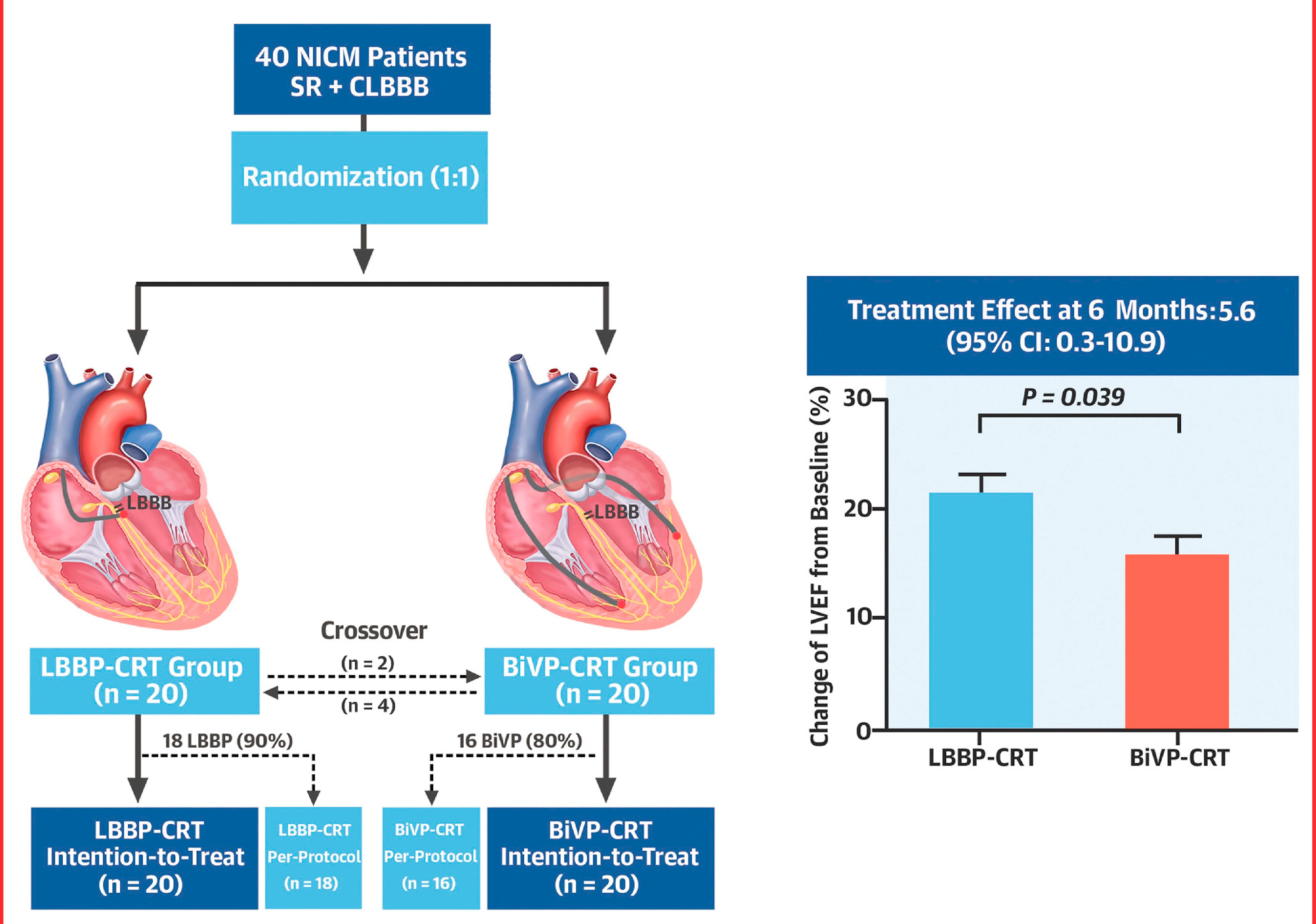 lbbb_resync.jpg