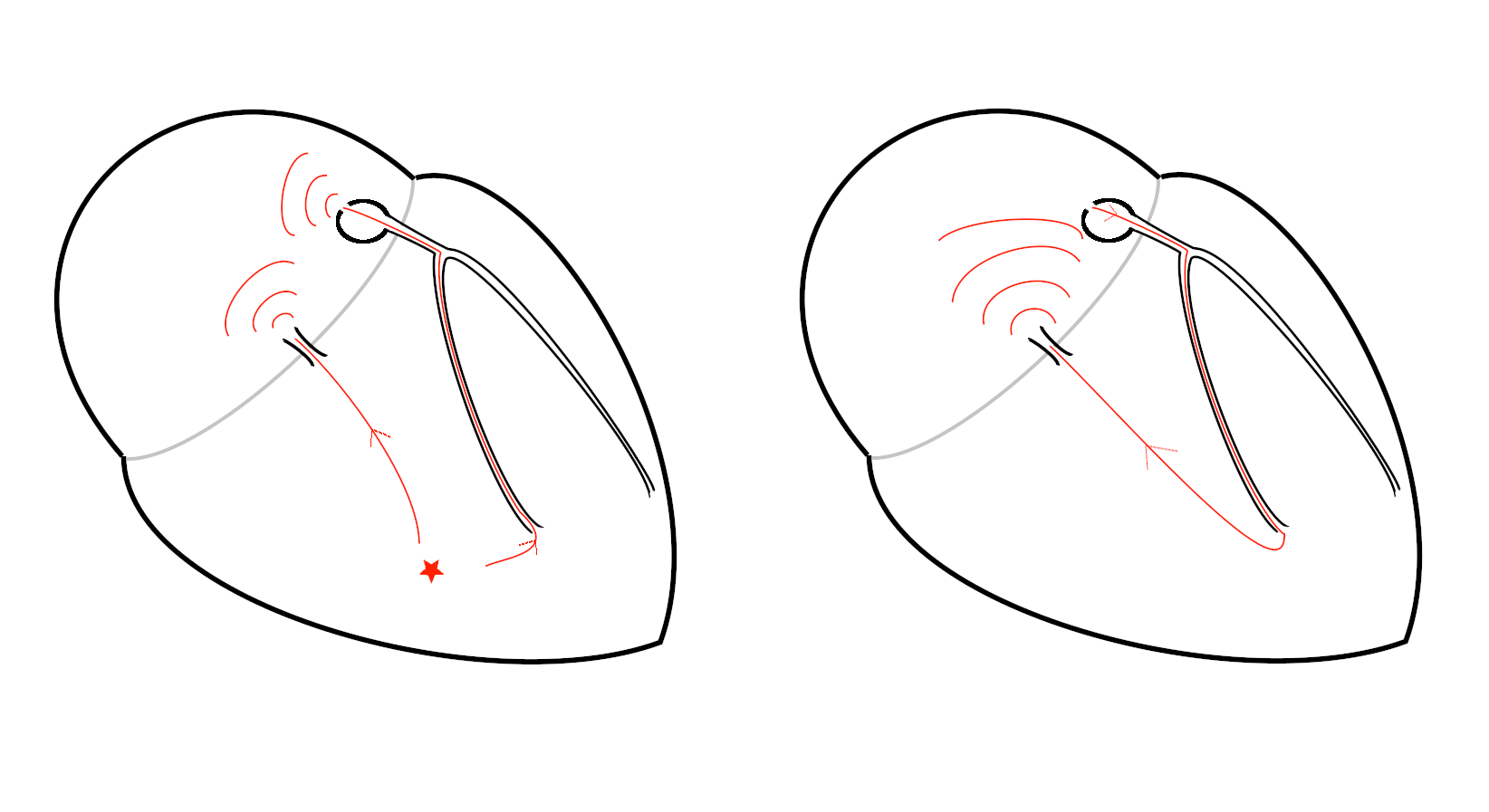 a_insertion.png