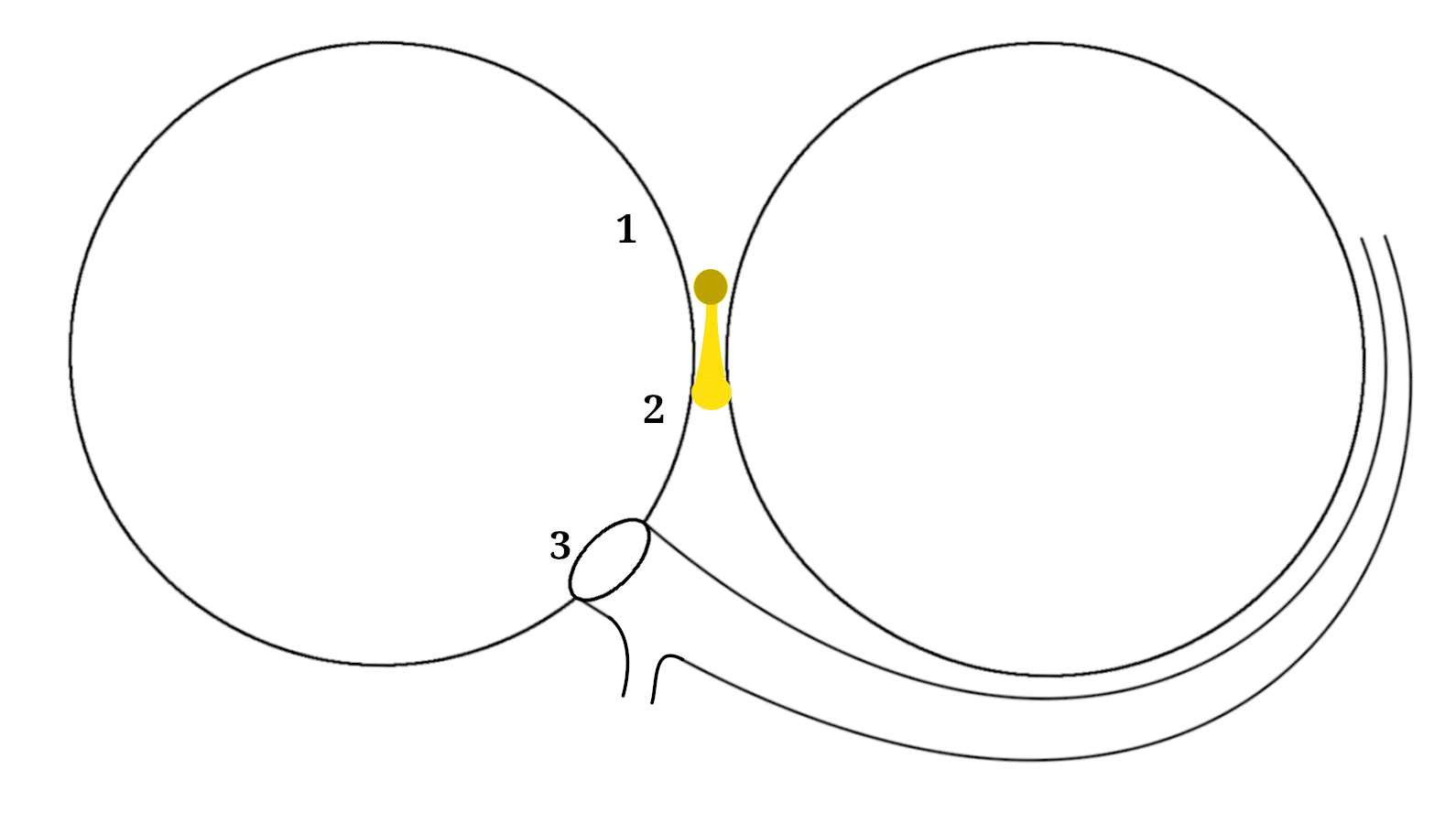 septal_ap_av_block.png