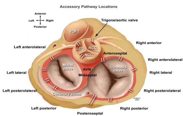 septal_anatomy.jpg