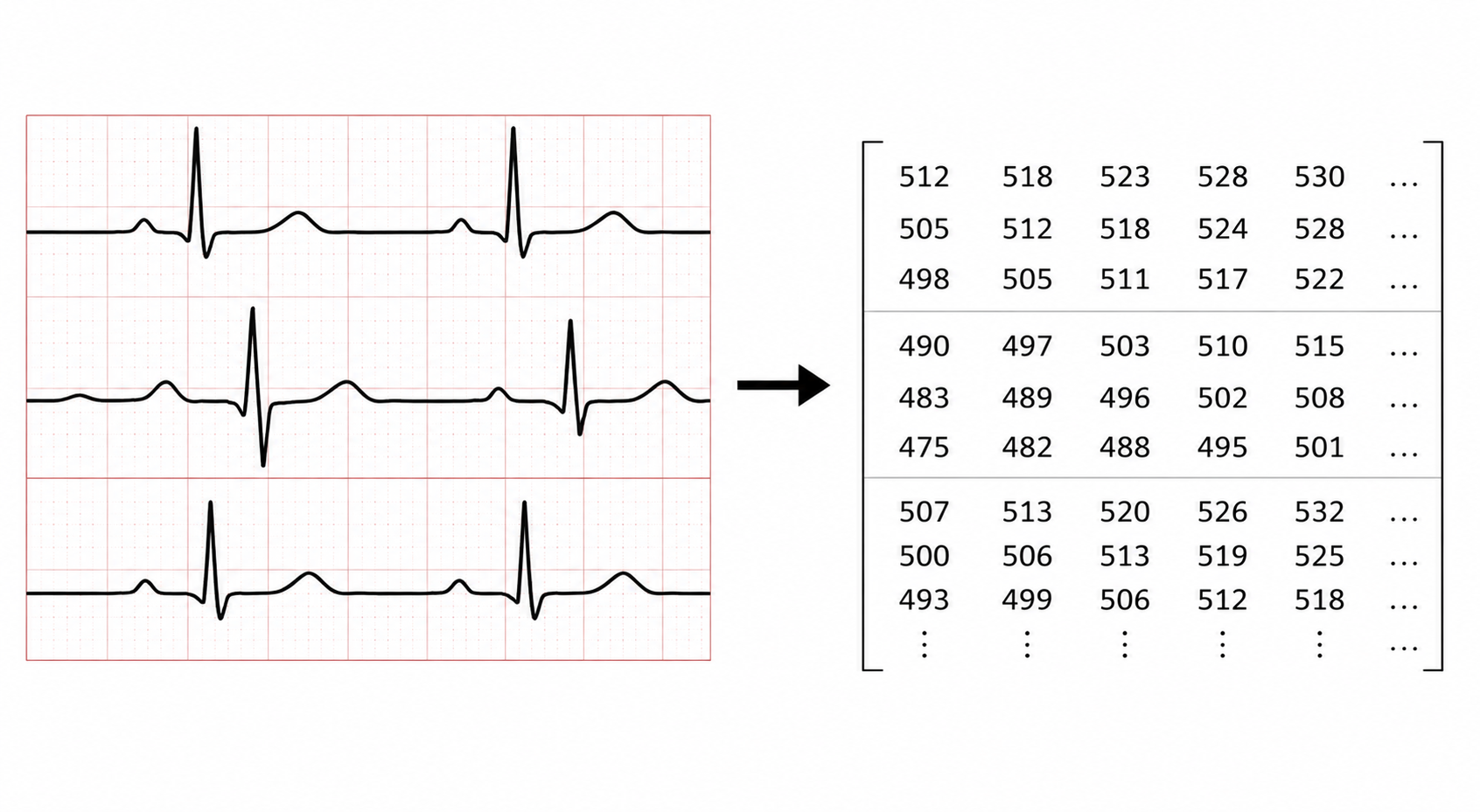 digital_ecg.png