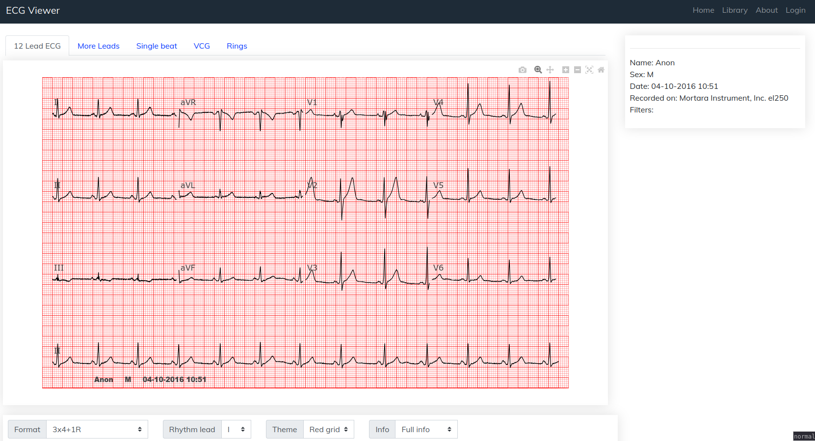 ecgviewer.png