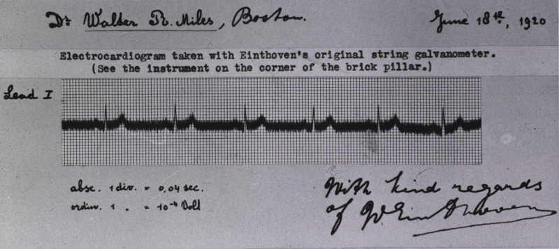 einthoven_ecg.jpg