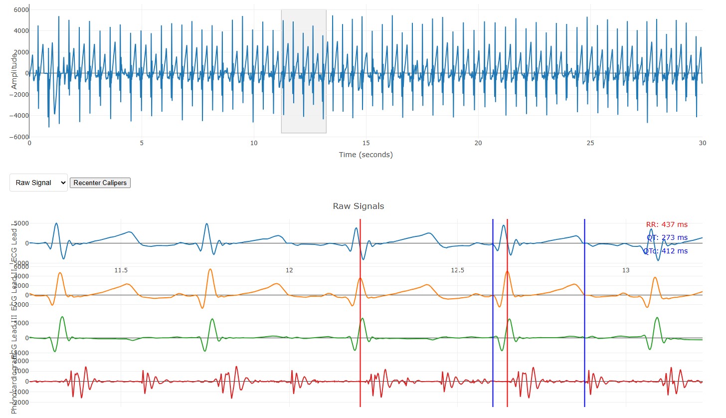 ecg.jpg