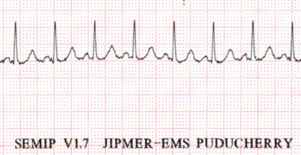 modern_ecg.jpg