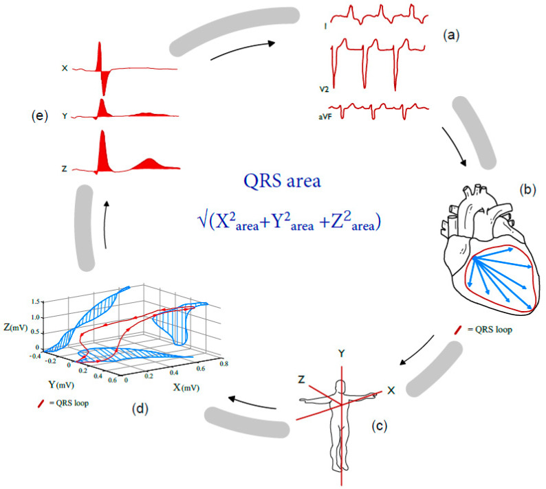 qrs_area.jpg