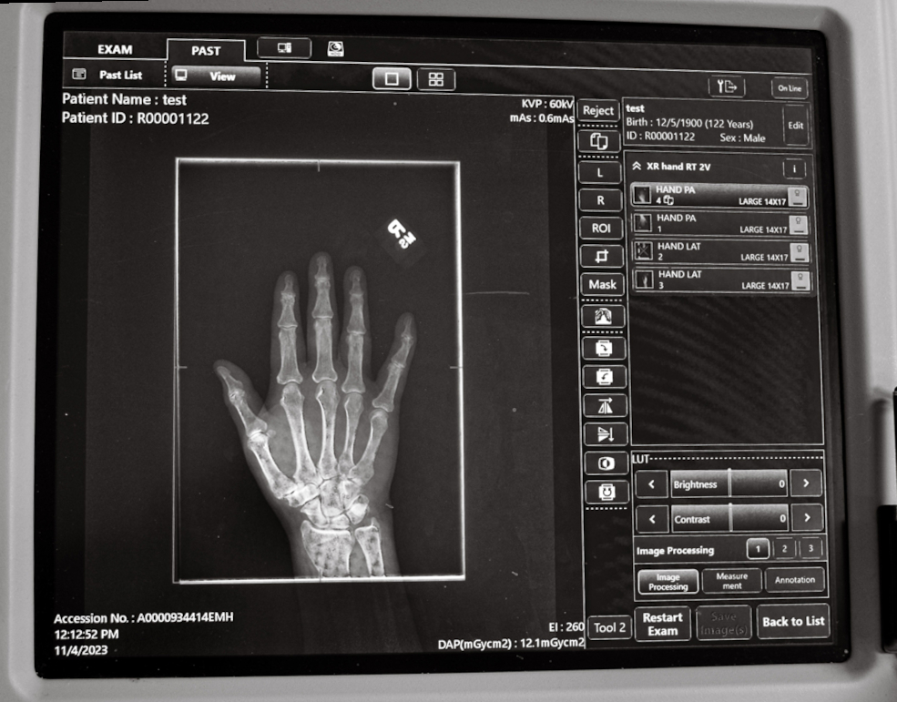 xray-hand.jpg