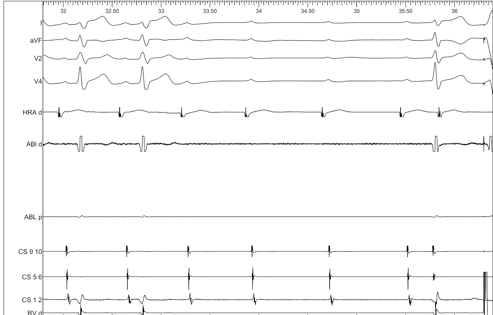 narmada_adenosine.png