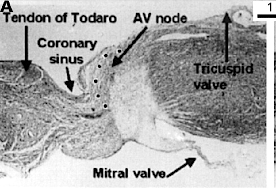 inferior_av_node.jpg
