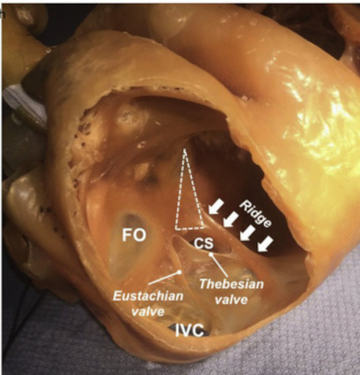 ridge.jpg