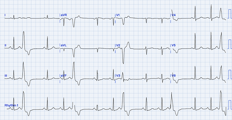 rvot2.png